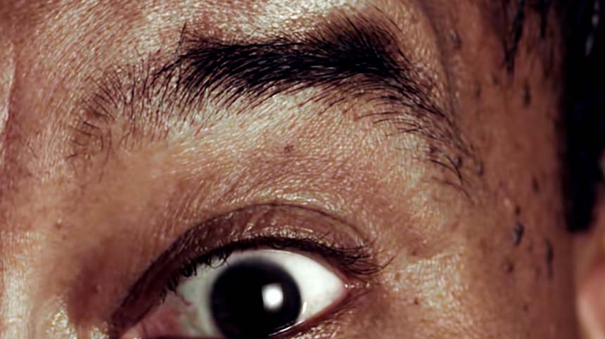 ALDI-EYE-2.jpg