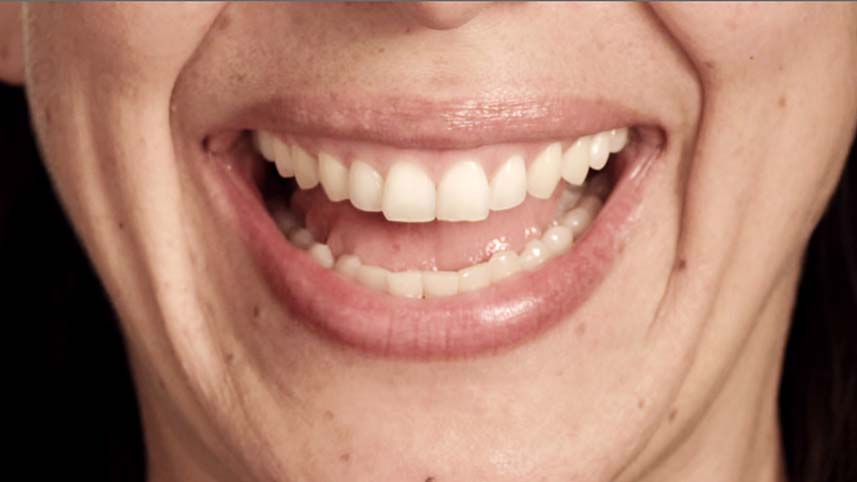 ALDI-MOUTH.jpg