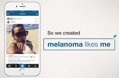 Melanoma-likes-me-thumb-400x262-197165.jpg