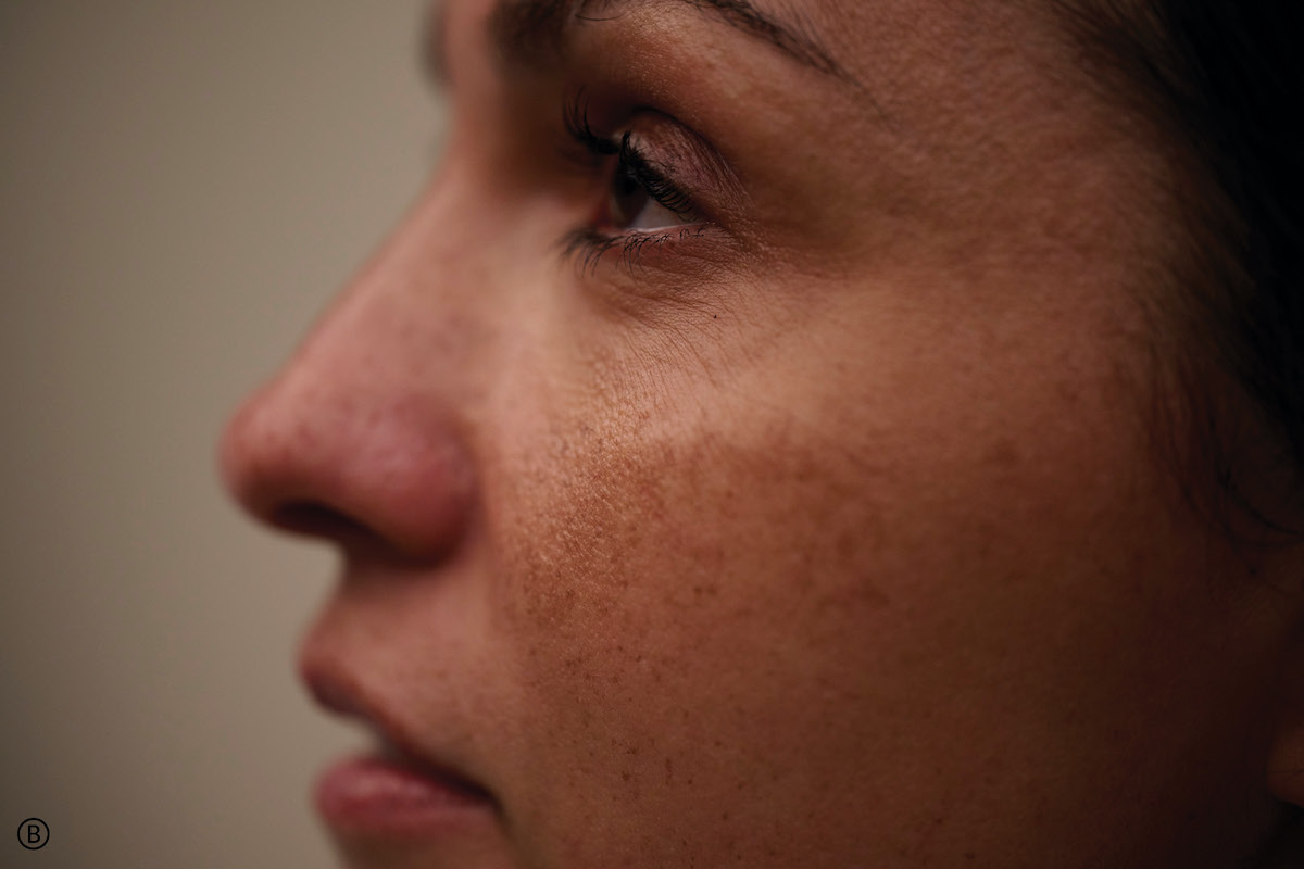 Bodyright urges us to be Unretouched and Unashamed with new ‘March Unfiltered’ movement and campaign via TBWA\NZ