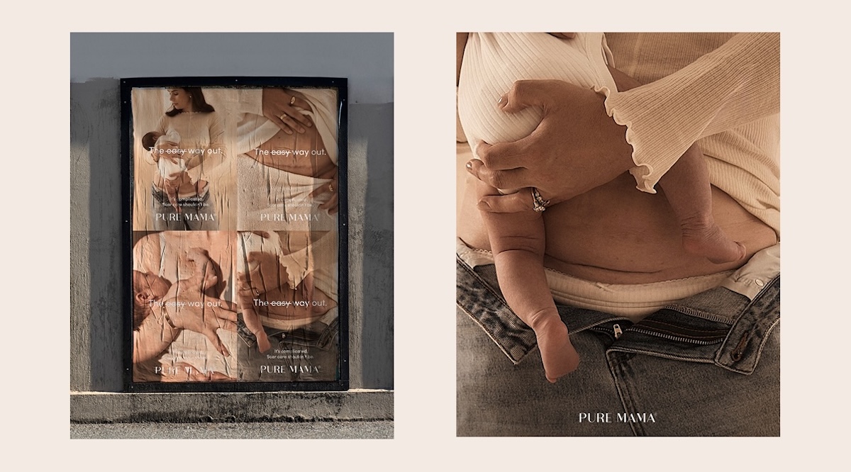 PURE MAMA Skincare strikes out the c-section stigma in new campaign via Willow & Blake
