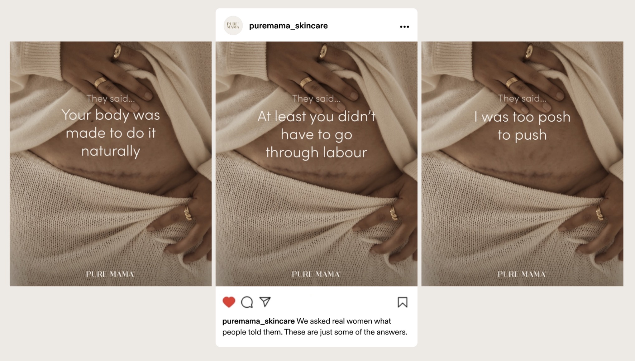 PURE MAMA Skincare strikes out the c-section stigma in new campaign via Willow & Blake