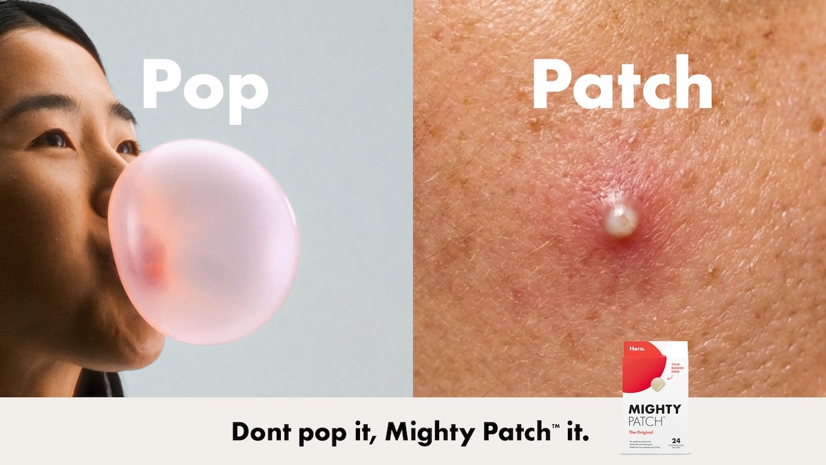 Hero Mighty Patch wants Aussies to pop everything but their pimples via Bounce