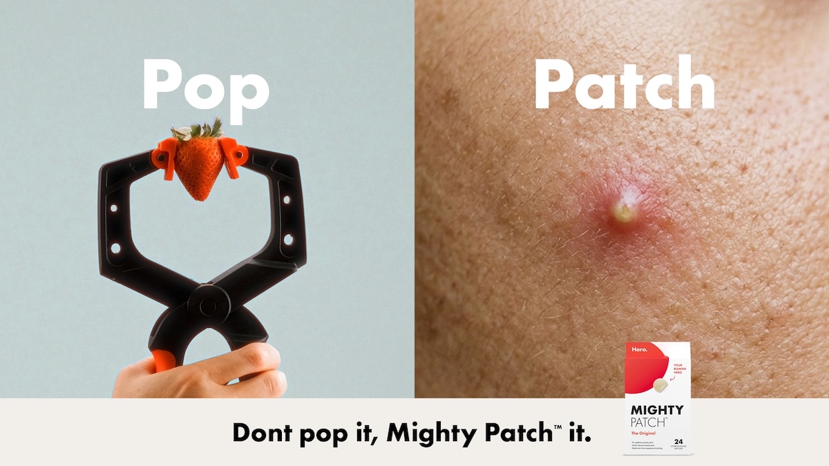 Hero Mighty Patch wants Aussies to pop everything but their pimples via Bounce
